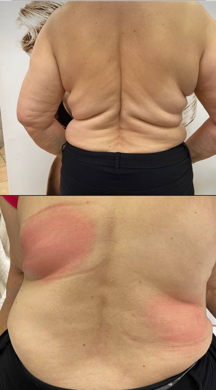 🔵#فروش
   🏙شهر: کلن ، آلمان
   توضیحات: 🎉 تخفیف ویژه تابستانی!❄️

الان وقتشه که با قیمت  استثنایی، کرایولیپولیز رو امتحان کنی !
  
فقط برای مدت محدود⏳

رزرو وقت :
 
📞 01777576937

Schabnam Beauty کلن

   👤 ارتباط با شخص |
@hamshahri_alman
صفحه پذیرنده و کاربر آگهی 