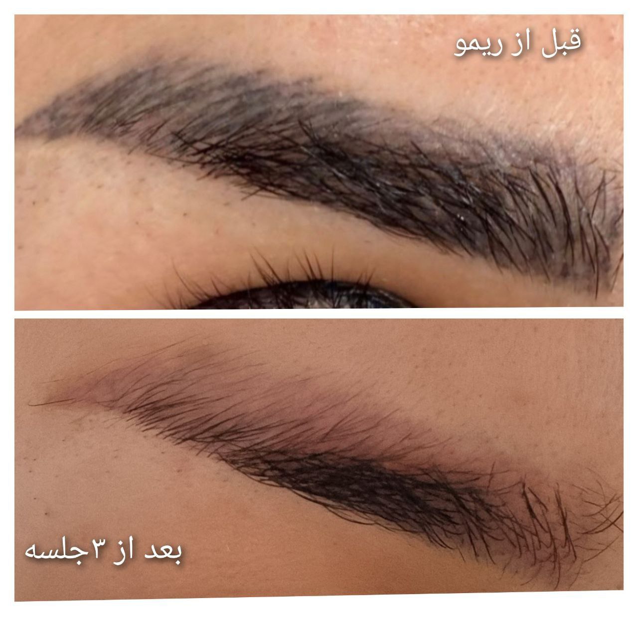 🔵#فروش
   🏙شهر: برلین ، آلمان
   توضیحات: تخفیف ویژه برای خانم ها و آقایان برای مدت محدود!
اگر از تتوی قدیمی خود خسته شده اید و به دنبال راهی برای ریمو آن هستید، این پیشنهاد خاص برای شماست. 
✅️با استفاده از بهترین و ایمن ترین مواد روز دنیا فی ریمووال 
اگه دوست داری از تاتوی قدیمی خلاص بشی، الان وقتشه
@Minervabeautyde

   👤 ارتباط با شخص |
@hamshahri_alman
صفحه پذیرنده و کاربر آگهی 